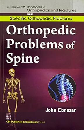 John Ebnezar CBS Handbooks in Orthopedics and Fractures: Specific Orthopedic Problems :Orthopedic Problems of  Spine