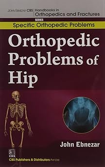 John Ebnezar CBS Handbooks in Orthopedics and Fractures: Specific Orthopedic Problems :Orthopedic Problems of  Hip