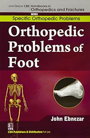 John Ebnezar CBS Handbooks in Orthopedics and Fractures: Specific Orthopedic Problems :Orthopedic Problems of  Foot