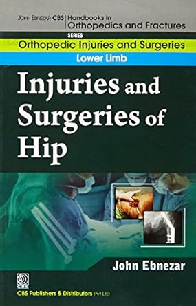 John Ebnezar CBS Handbooks in Orthopedics and Fractures: Orthopedic Injuries and Surgeries : Lower Limb : Injuries and Surgeries of Hip