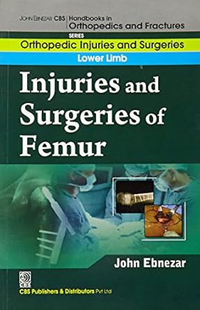 John Ebnezar CBS Handbooks in Orthopedics and Fractures: Orthopedic Injuries and Surgeries : Lower Limb : Injuries and Surgeries of Femur