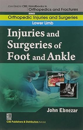 John Ebnezar CBS Handbooks in Orthopedics and Fractures: Orthopedic Injuries and Surgeries : Lower Limb : Injuries and Surgeries of Foot and Ankle