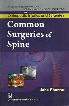 John Ebnezar Series:  Common Surgeries of Spine