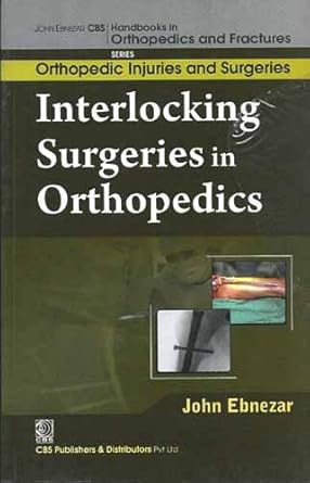 John Ebnezar CBS Handbooks in Orthopedics and Fractures: Orthopedic Injuries and Surgeries : Interlocking Surgeries in Orthopedics