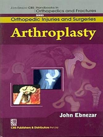 John Ebnezar Series: Arthroplasty