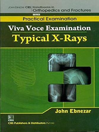 John Ebnezar CBS Handbooks in Orthopedics and Fractures: Practical Examination : Viva Voce Examination: Typical X-Rays