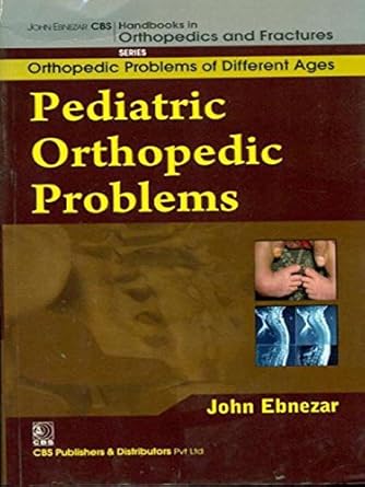 John Ebnezar CBS Handbooks in Orthopedics and Fractures: Orthopedic Problems of Different Ages : Pediatric Orthopedic Problems