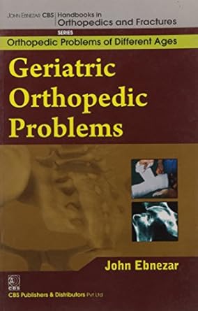 John Ebnezar CBS Handbooks in Orthopedics and Fractures: Orthopedic Problems of Different Ages : Geriatric Orthopedic Problems