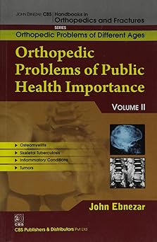 John Ebnezar CBS Handbooks in Orthopedics and Fractures: Orthopedic Problems of Different Ages : Orthopedic Problems of Public Health Importance II