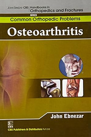 John Ebnezar CBS Handbooks in Orthopedics and Fractures: Common Orthopedic Problems  : Osteoarthritis