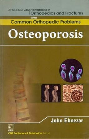 John Ebnezar CBS Handbooks in Orthopedics and Fractures: Common Orthopedic Problems  : Osteoporosis