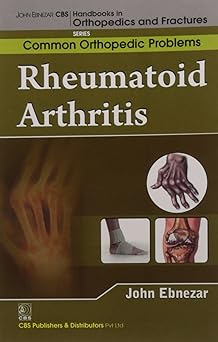 John Ebnezar CBS Handbooks in Orthopedics and Fractures: Common Orthopedic Problems  : Rheumatoid Arthritis