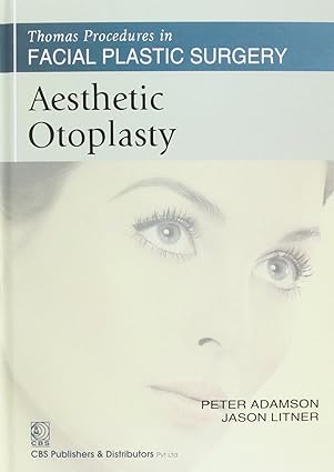 Thomas Procedures in Facial Plastic Surgery: Aesthetic Otoplasty (HB)