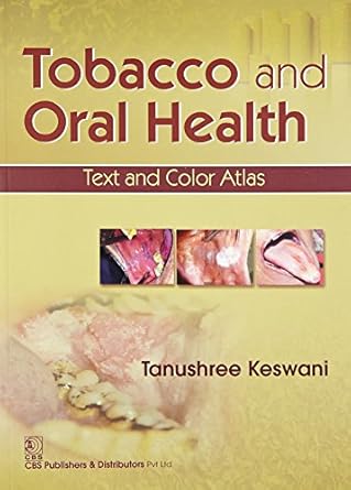 Tobacco and Oral Health: Text and Color Atlas (PB)