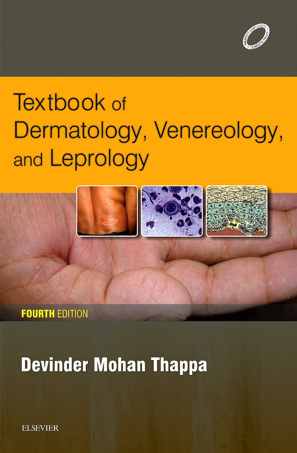 Textbook of Dermatology, Venereology, and Leprology, 4e