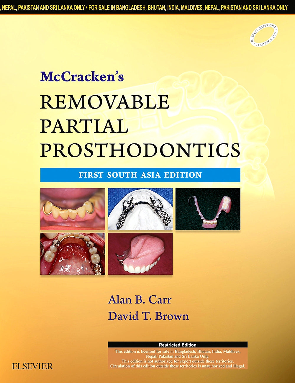 Mc Cracken's Removable Partial Prosthodontics: First South Asia Edition