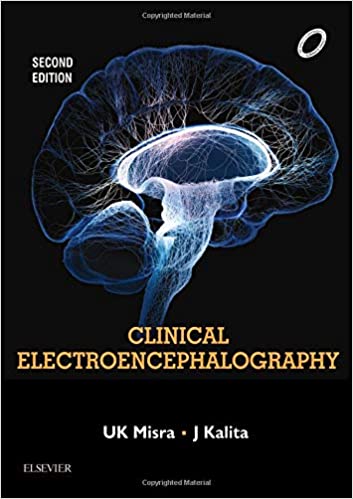 Clinical Electroencephalography, 2e