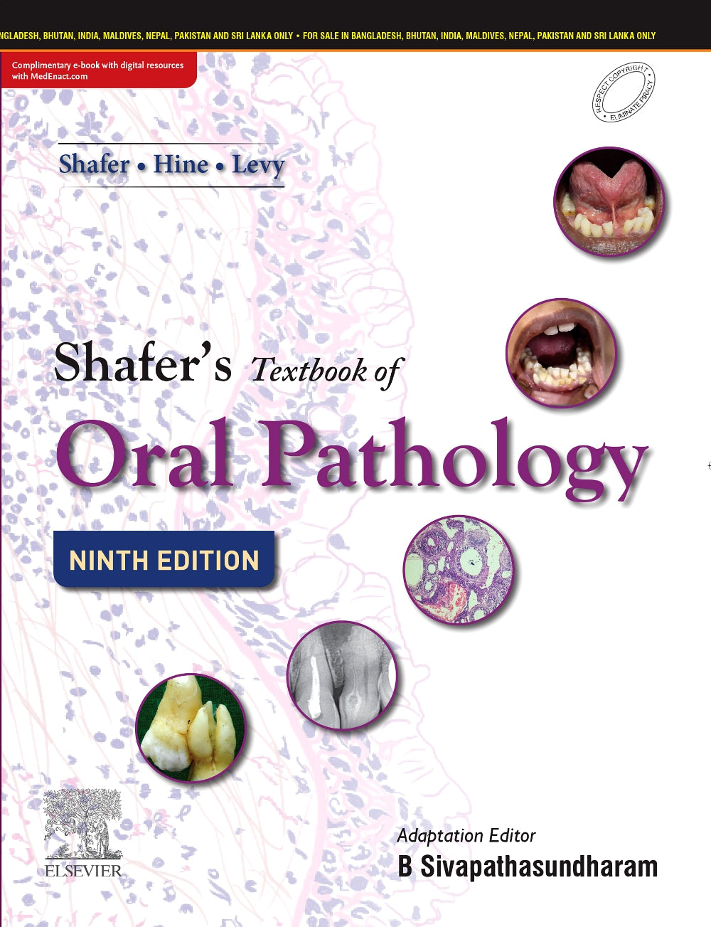 Shafer's Textbook of Oral Pathology, 9e