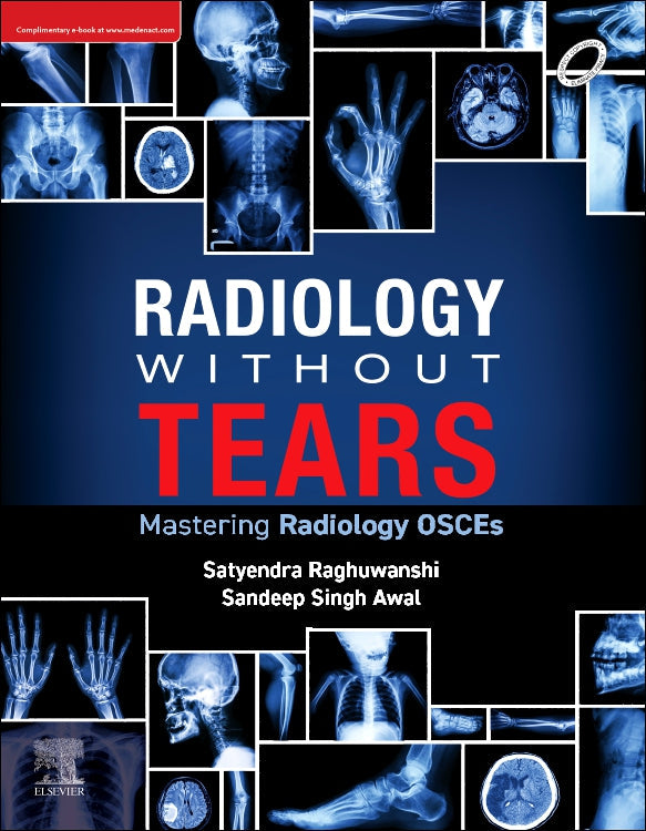 Radiology Without Tears: Mastering Radiology OSCEs