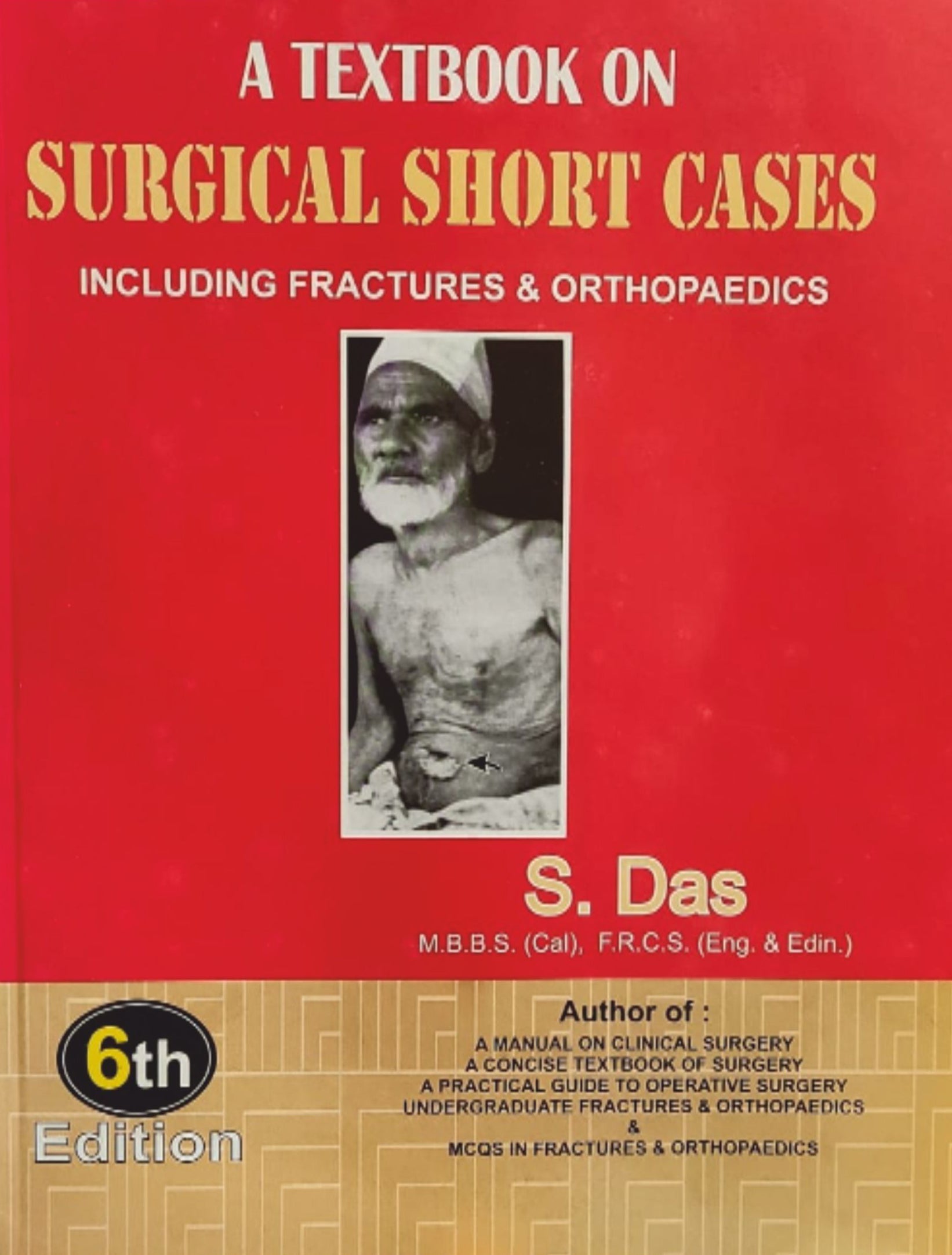 A TEXTBOOK ON SURGICAL SHORT CASES INCLUDING FRACTURES & ORTHOPAEDICS