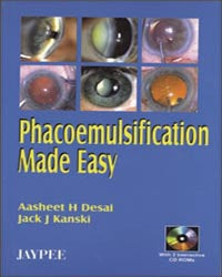 PHACOEMULSIFICATION MADE EASY WITH 2 INT.CD ROMS