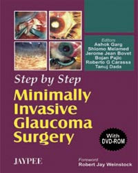 STEP BY STEP MINIMALLY INVASIVE GLAUCOMA SURGERY WITH DVD-ROM