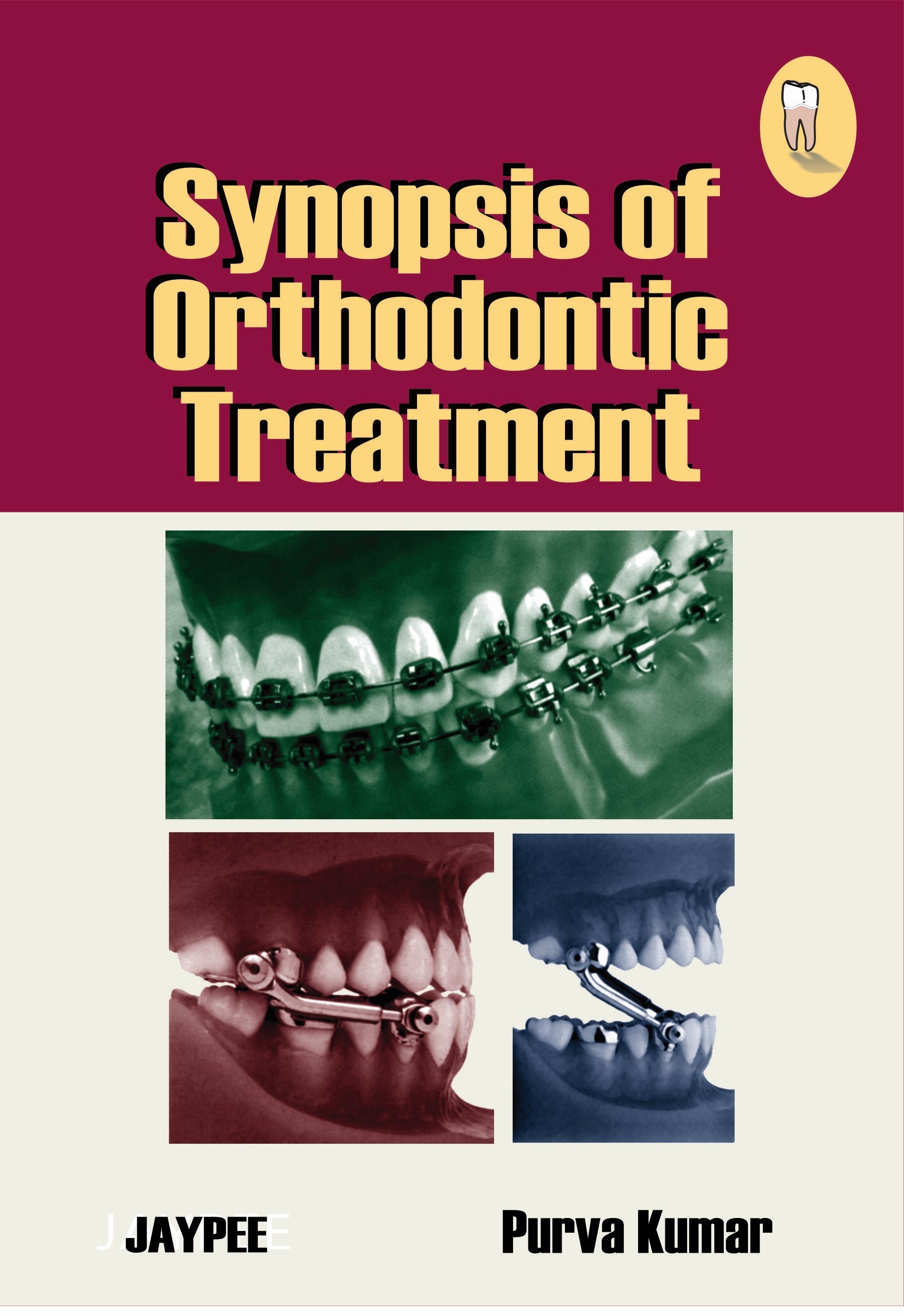 SYNOPSIS OF ORTHODONTIC TREATMENT