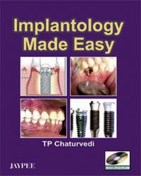 IMPLANTOLOGY MADE EASY WITH DVD-ROM