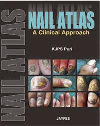 NAIL ATLAS A CLINICAL APPROACH