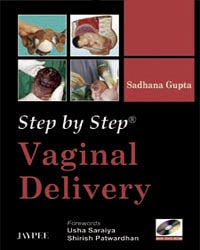 STEP BY STEP VAGINAL DELIVERY WITH DVD-ROM