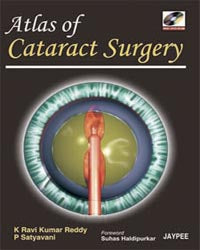 ATLAS OF CATARACT SURGERY WITH DVD ROM