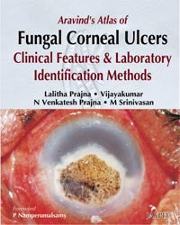 ARAVIND'S ATLAS OF FUNGAL CORNEAL ULCERS CLINICAL FEATURES & LAB.IDENTIFICATION METHODS