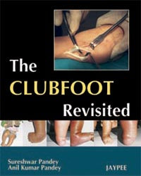 THE CLUBFOOT REVISITED