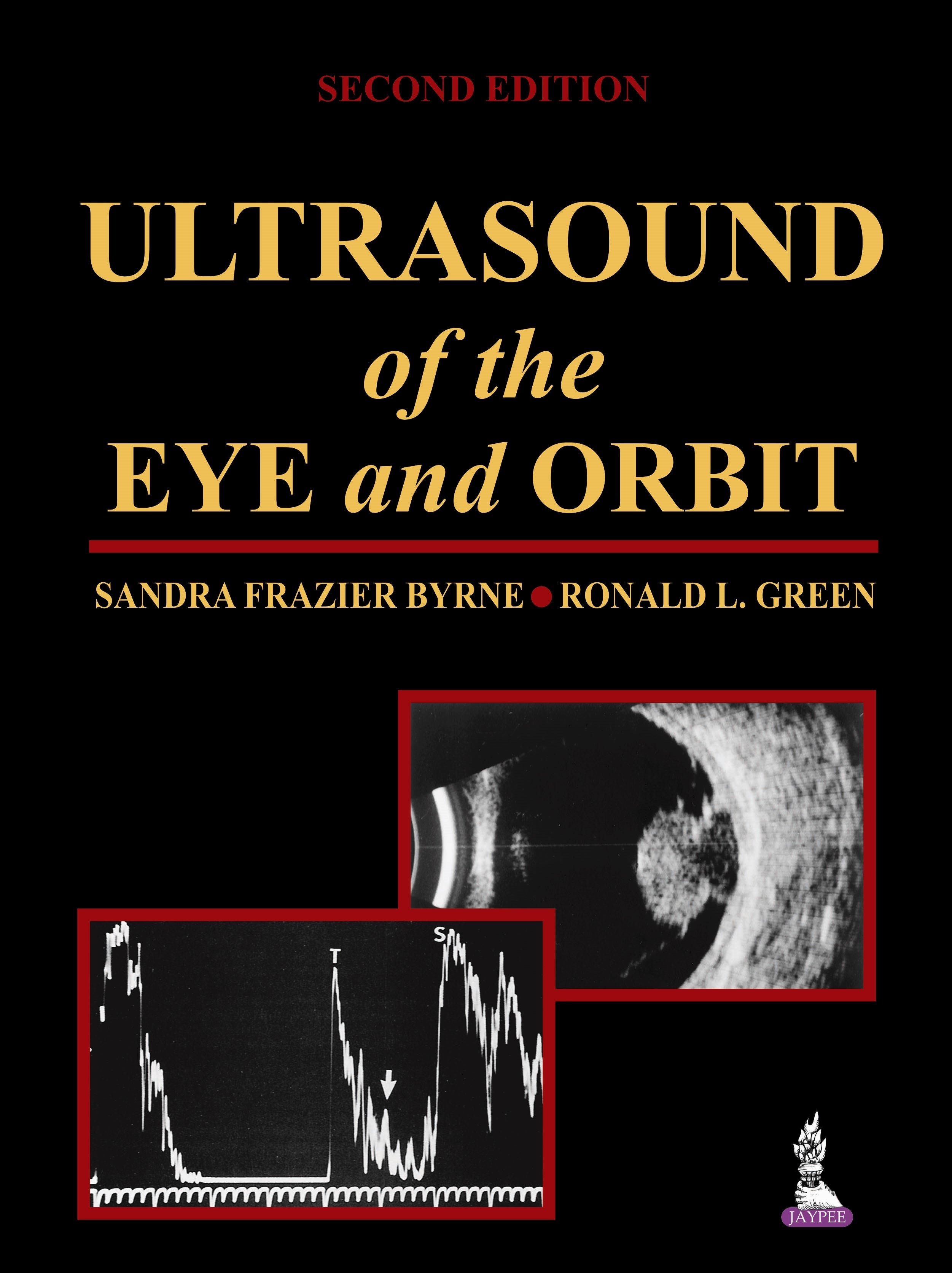 ULTRASOUND OF THE EYE AND ORBIT