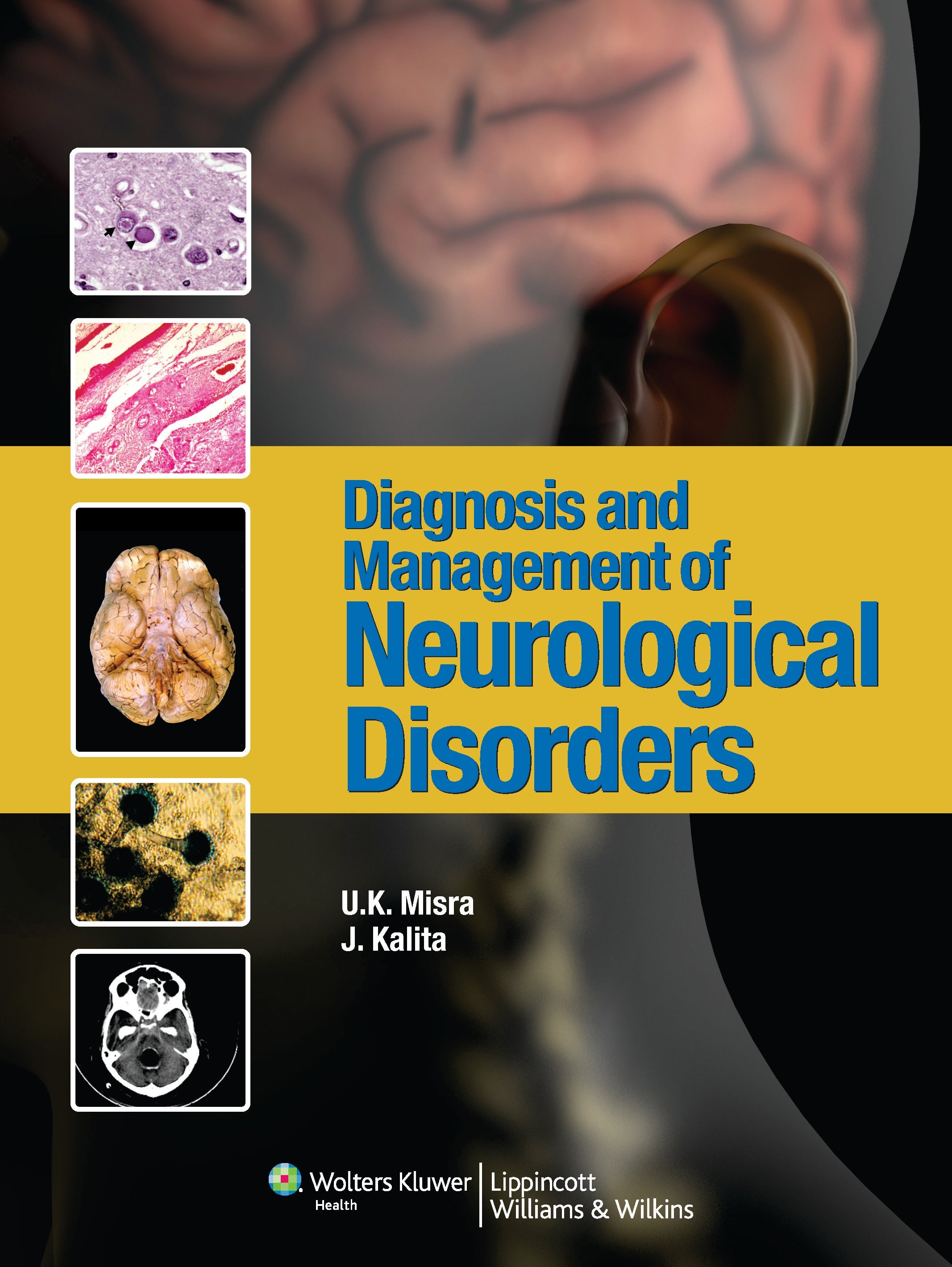 Diagnosis & Management of Neurological Disorders