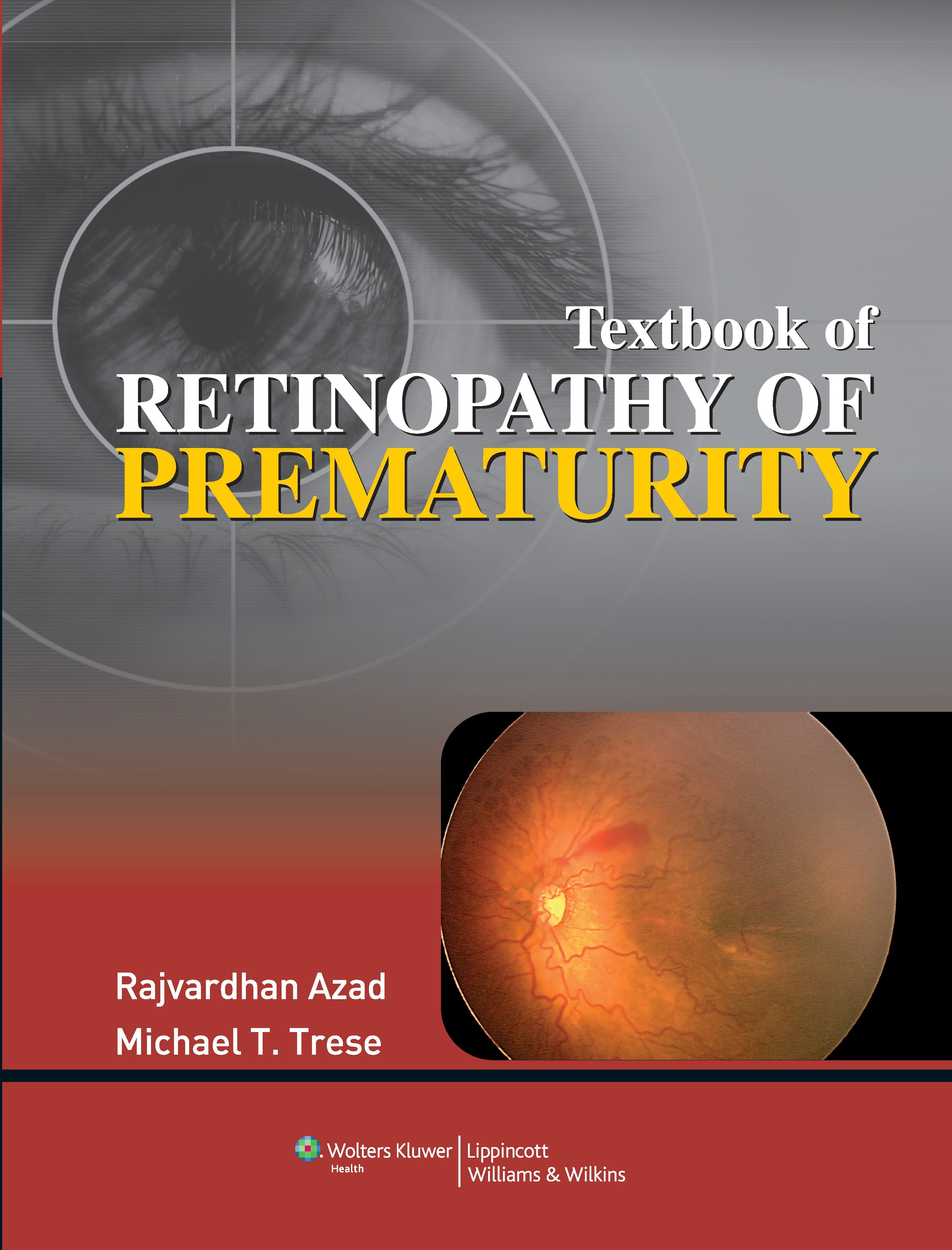 Textbook of Retinopathy of Prematurity