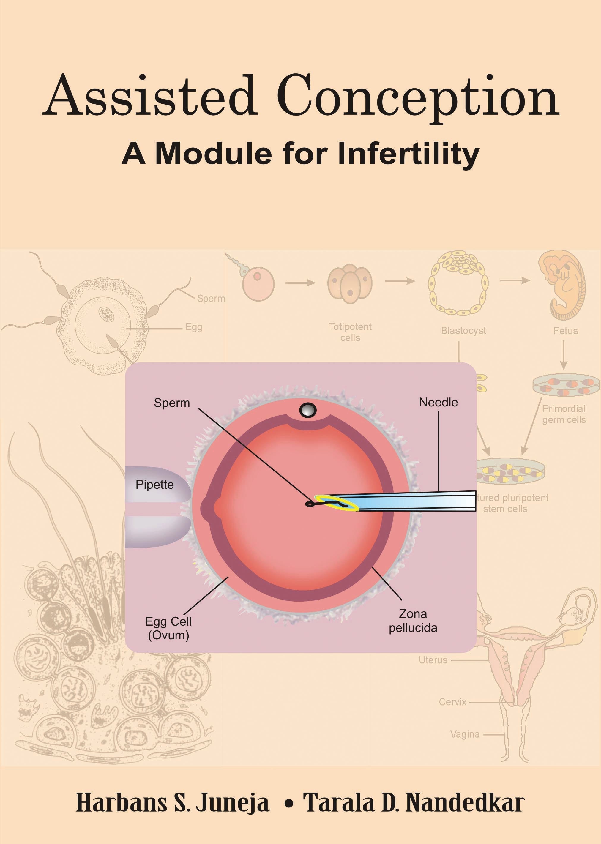 Assisted Conception: A Module For Infertility