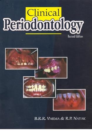 O.E.CURRENT CONCEPTS IN PERIODONTICS