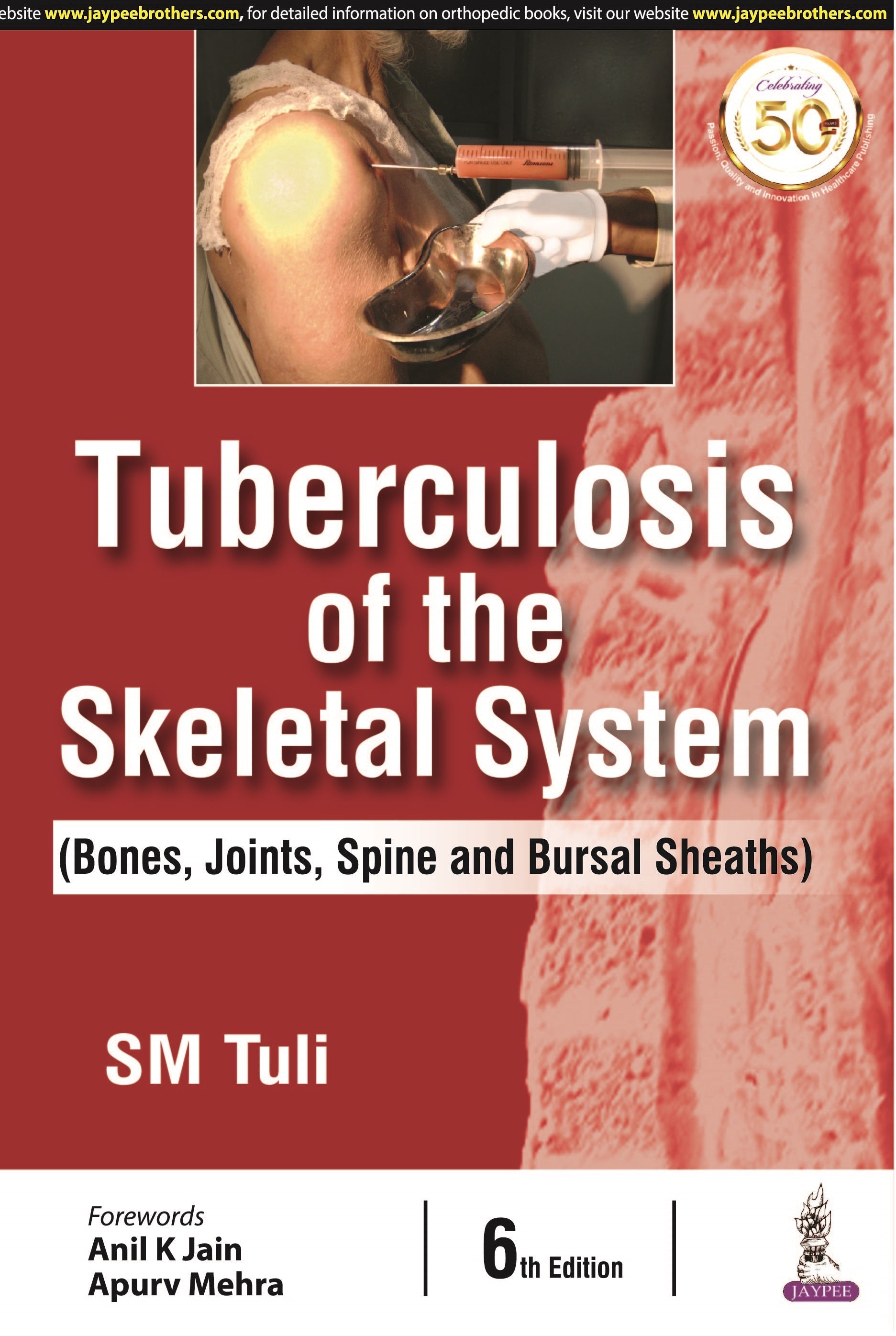 TUBERCULOSIS OF THE SKELETAL SYSTEM (BONES, JOINTS, SPINE AND BURSAL SHEATHS)