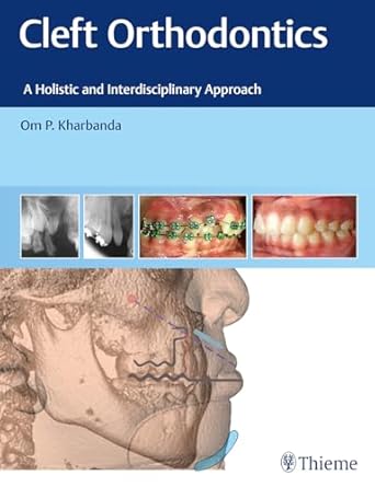 Cleft Orthodontics 1st Edition