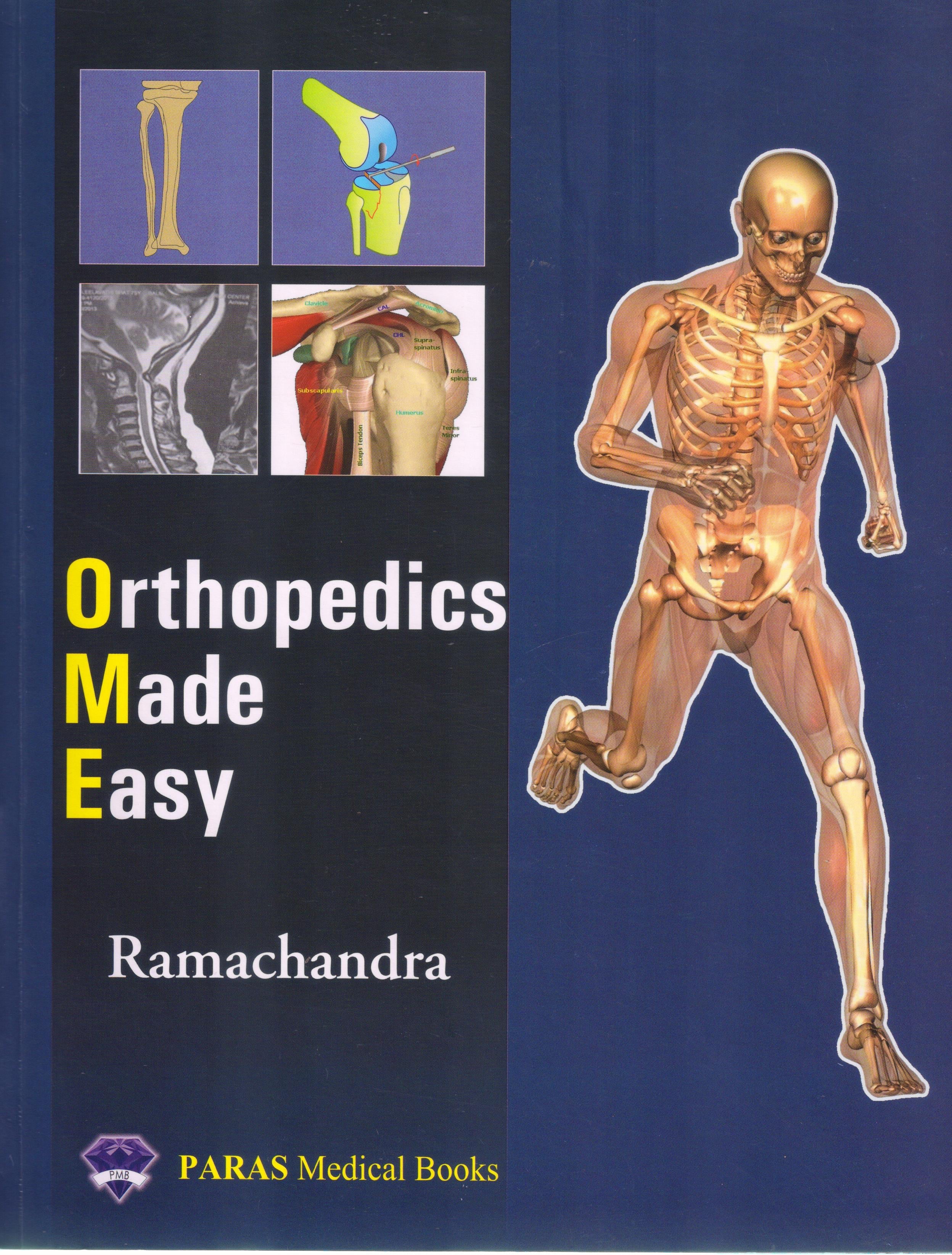 Orthopedics Made Easy
