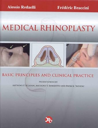 MEDICAL RHINOPLASTY BASIC PRINCIPLES AND CLINICAL