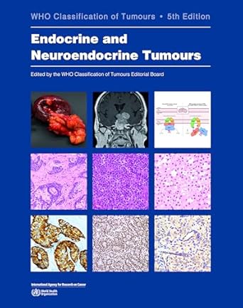 WHO Classification of Tumours Endocrine and Neuroendocrine Tumours 5th/2025