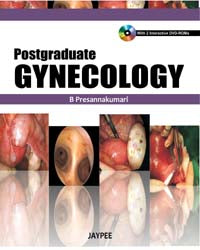 POSTGRADUATE GYNAECOLOGY WITH DVD ROM