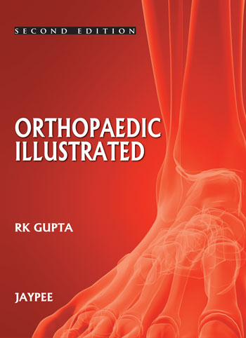 ORTHOPEDICS ILLUSTRATED