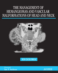 THE MANAGEMENT OF HEMANGIOMAS AND VASCULAR MALFORMATIONS OF HEAD AND NECK