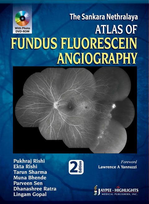 THE SANKARA NETHRALAYA ATLAS OF FUNDUS FLUORESCEIN ANGIOGRAPHY WITH PHOTO DVD-ROM