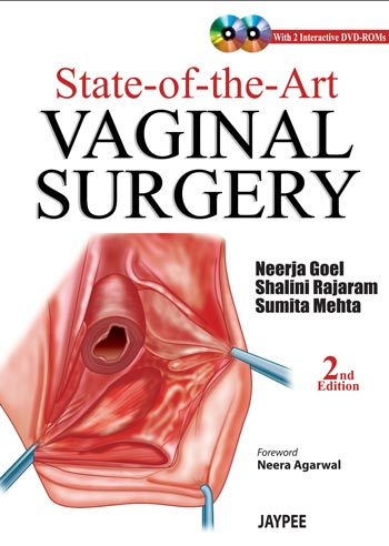 STATE-OF-THE ART VAGINAL SURGERY WITH 2-INTERACTIVE DVD-ROMS