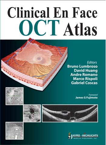 CLINICAL EN FACE OCT ATLAS