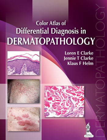 COLOR ATLAS OF DIFFERENTIAL DIAGNOSIS IN DERMATOPATHOLOGY